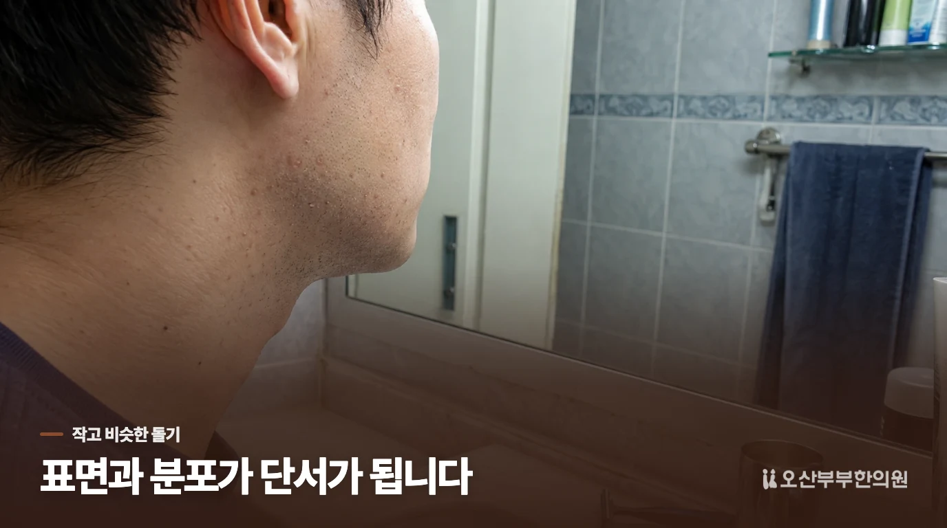 작고 납작한 돌기가 여러 개라면 모양을 살펴보세요