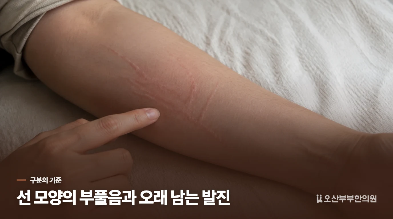 긁힌 자국과 두드러진 선은 이렇게 다릅니다