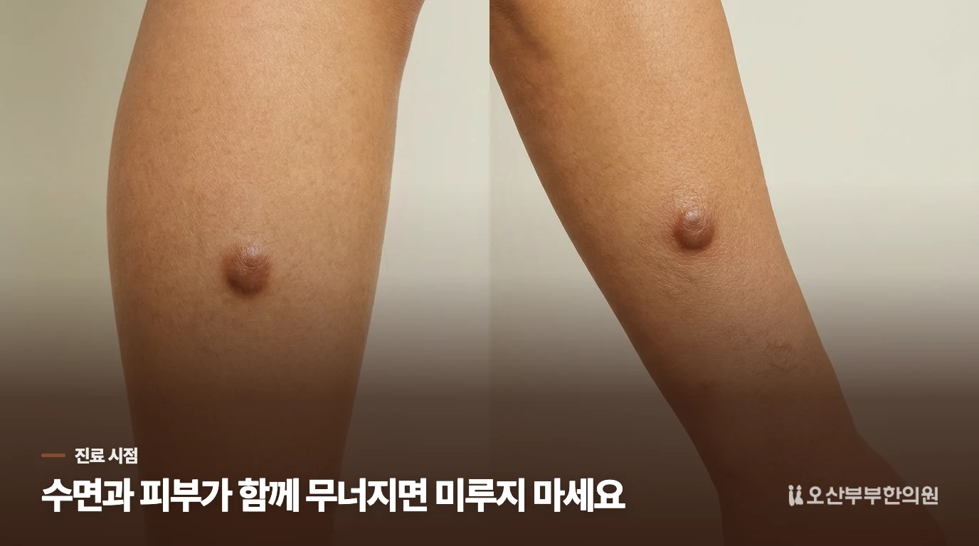 잠을 깨거나 상처가 생기면 피부과 평가를 서두릅니다