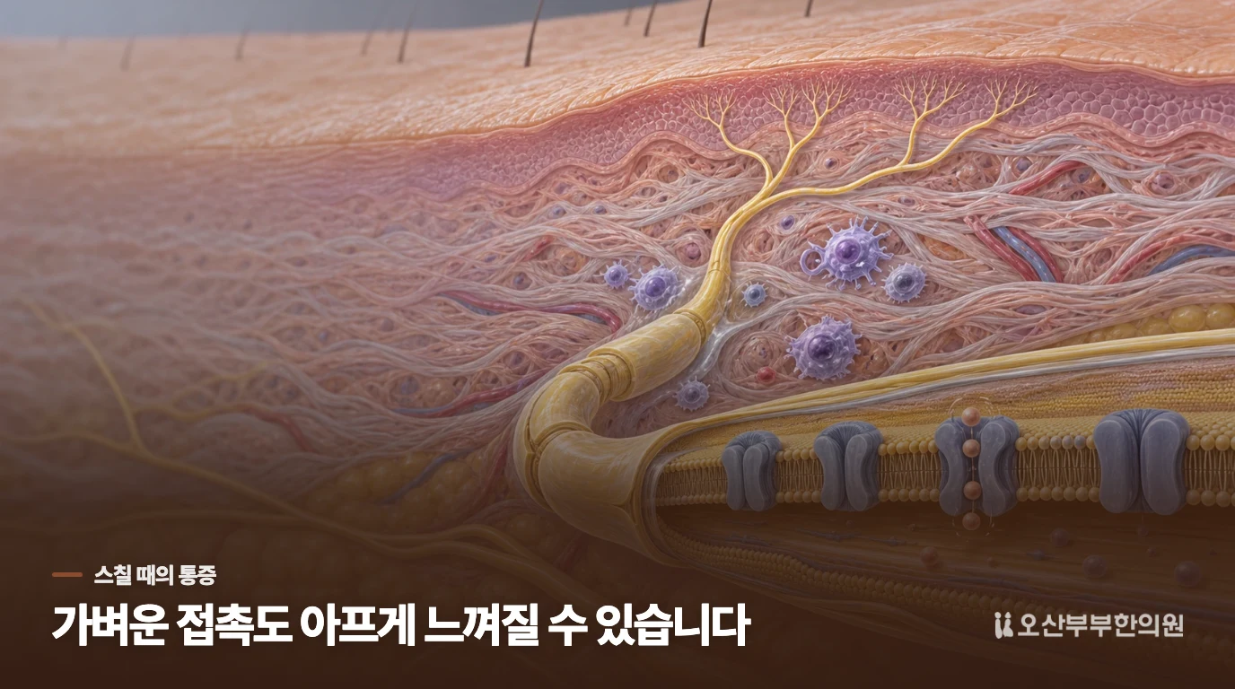 피부는 멀쩡한데 옷이 스치기만 해도 아픈 이유