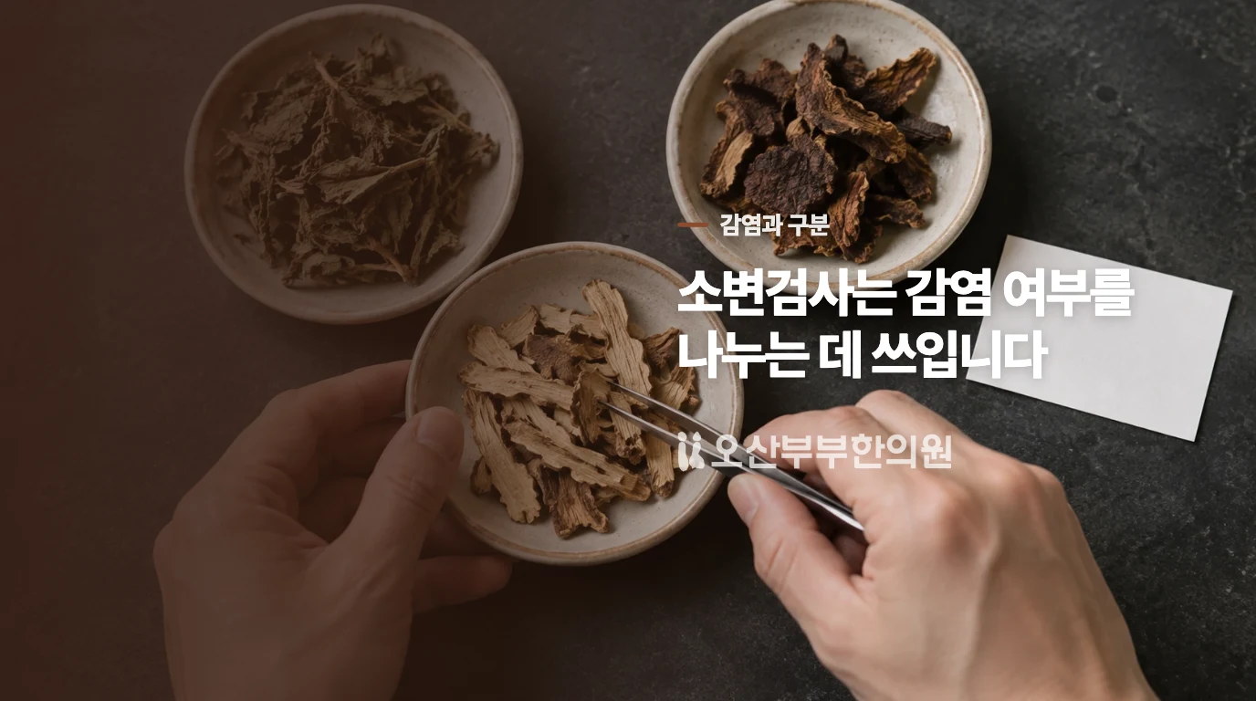 배뇨통이 감염인지 가르는 데 소변검사가 쓰입니다