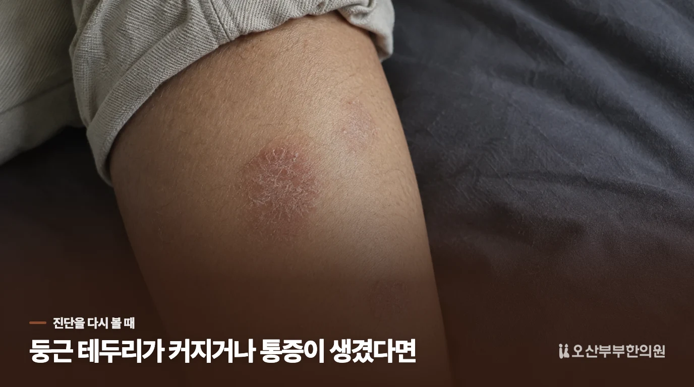 둥근 테두리가 커지거나 통증이 생겼다면