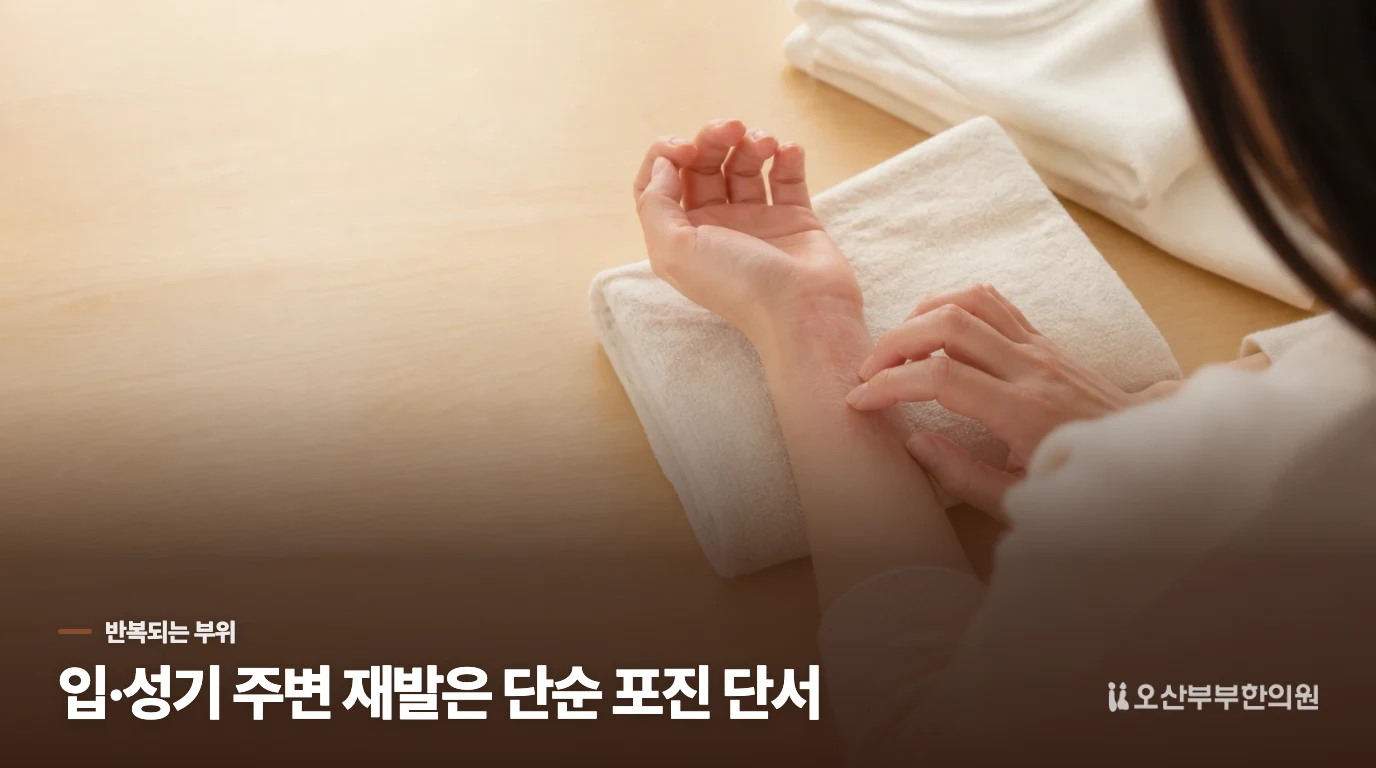 입이나 성기 주변에 되풀이되면 단순 포진 쪽 특징이 더 큽니다