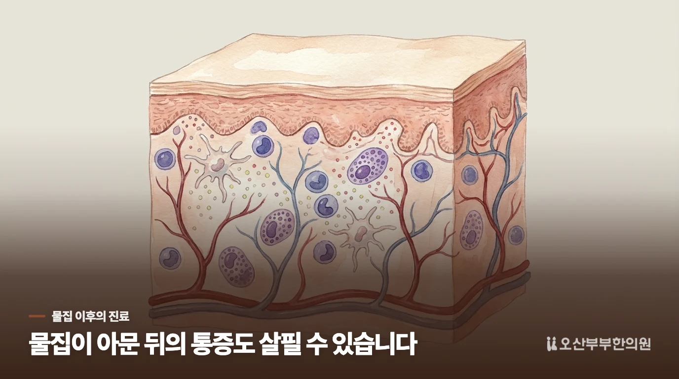 물집이 사라진 뒤에도 진료받을 이유