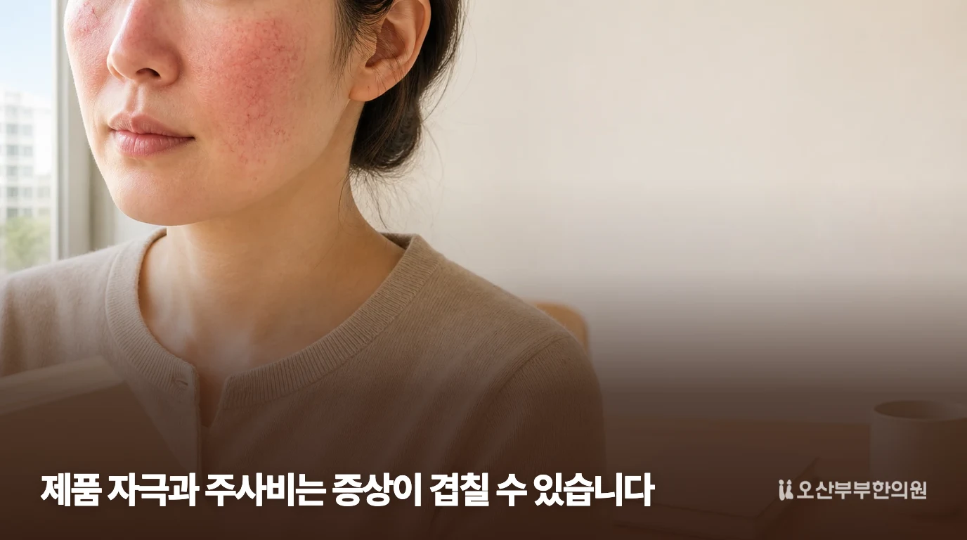 볼과 코 주변의 붉음을 보여주는 주사비 설명 이미지