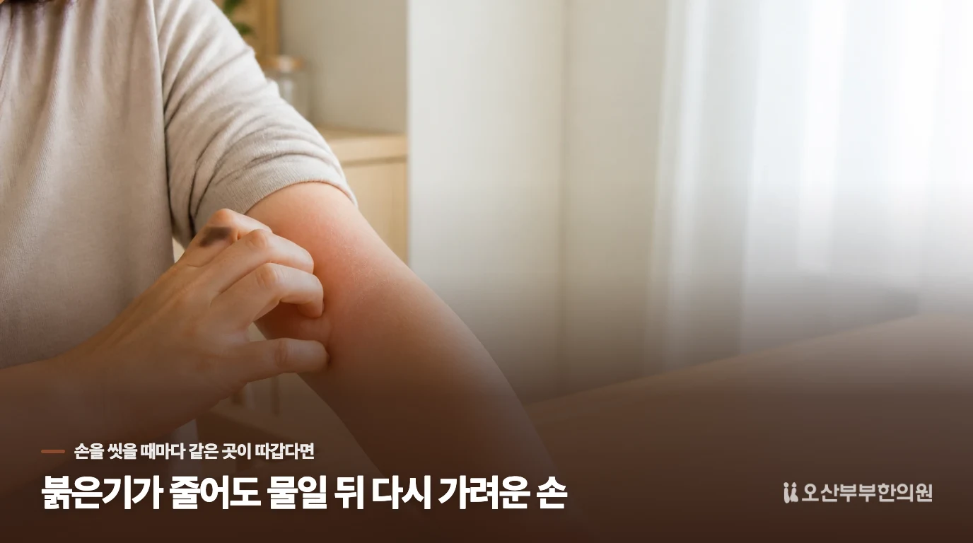 붉은기가 줄어도 물일 뒤 다시 가려운 손