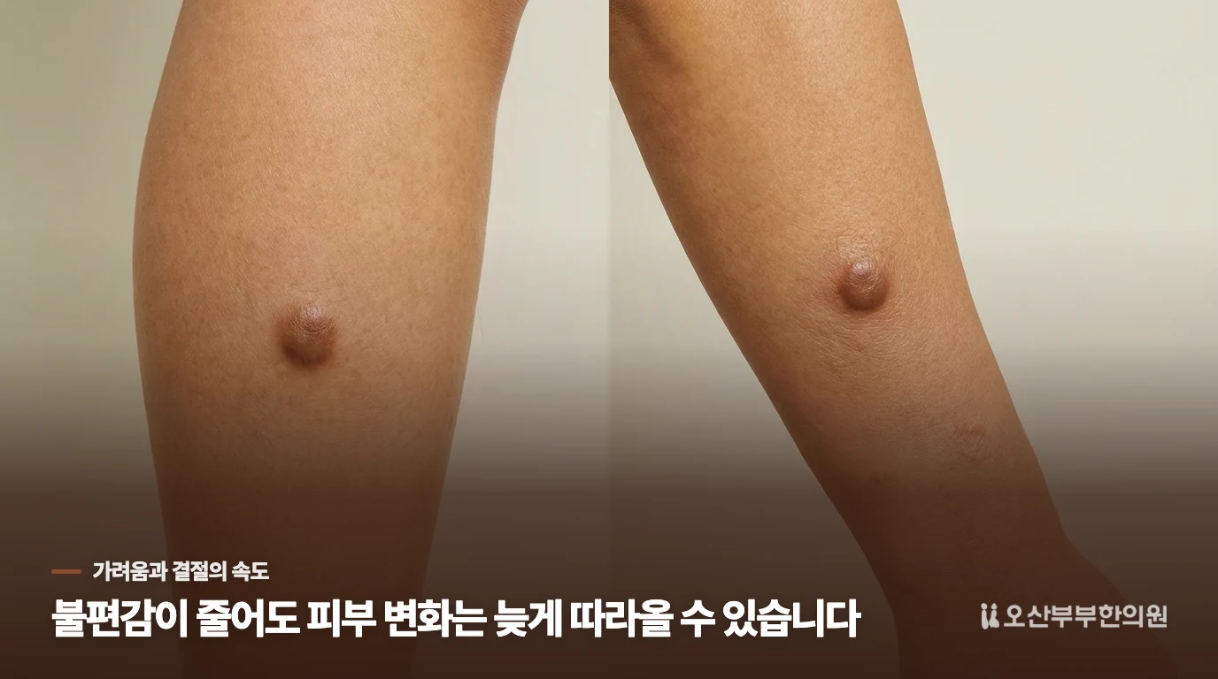 가려움이 줄어도 돌기는 남을 수 있습니다
