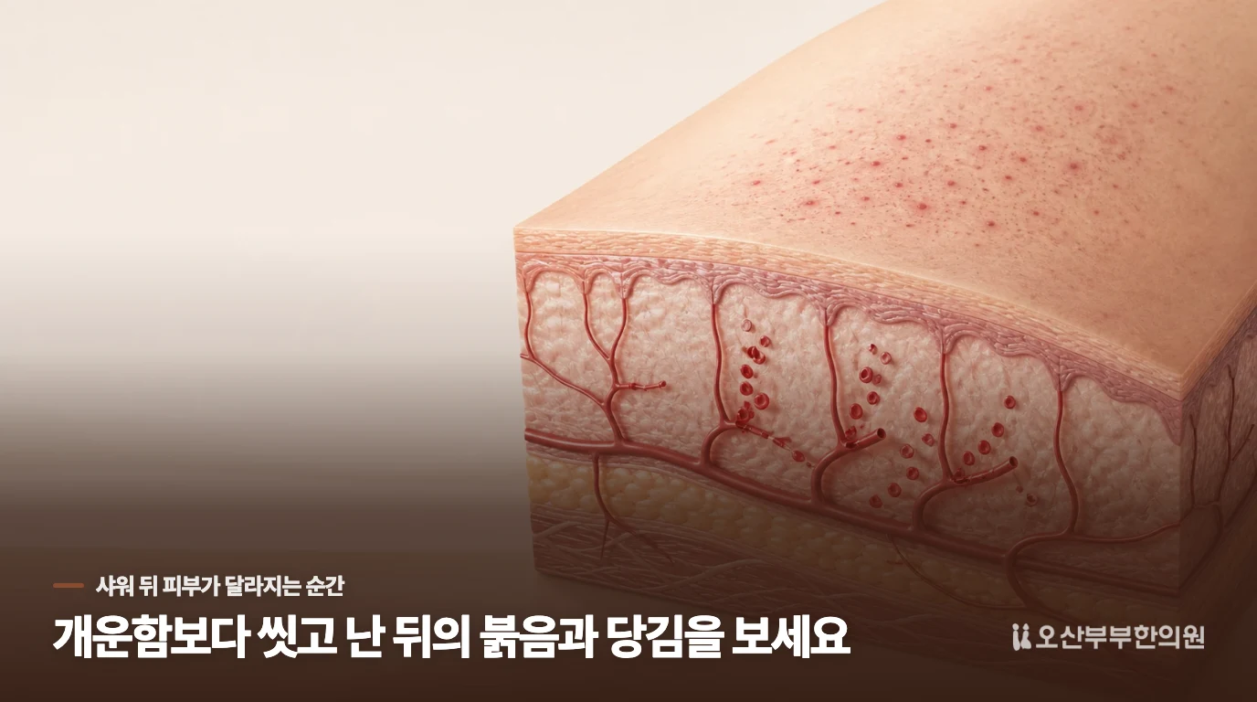 샤워를 끝내면 가려움이 더 커지는 이유