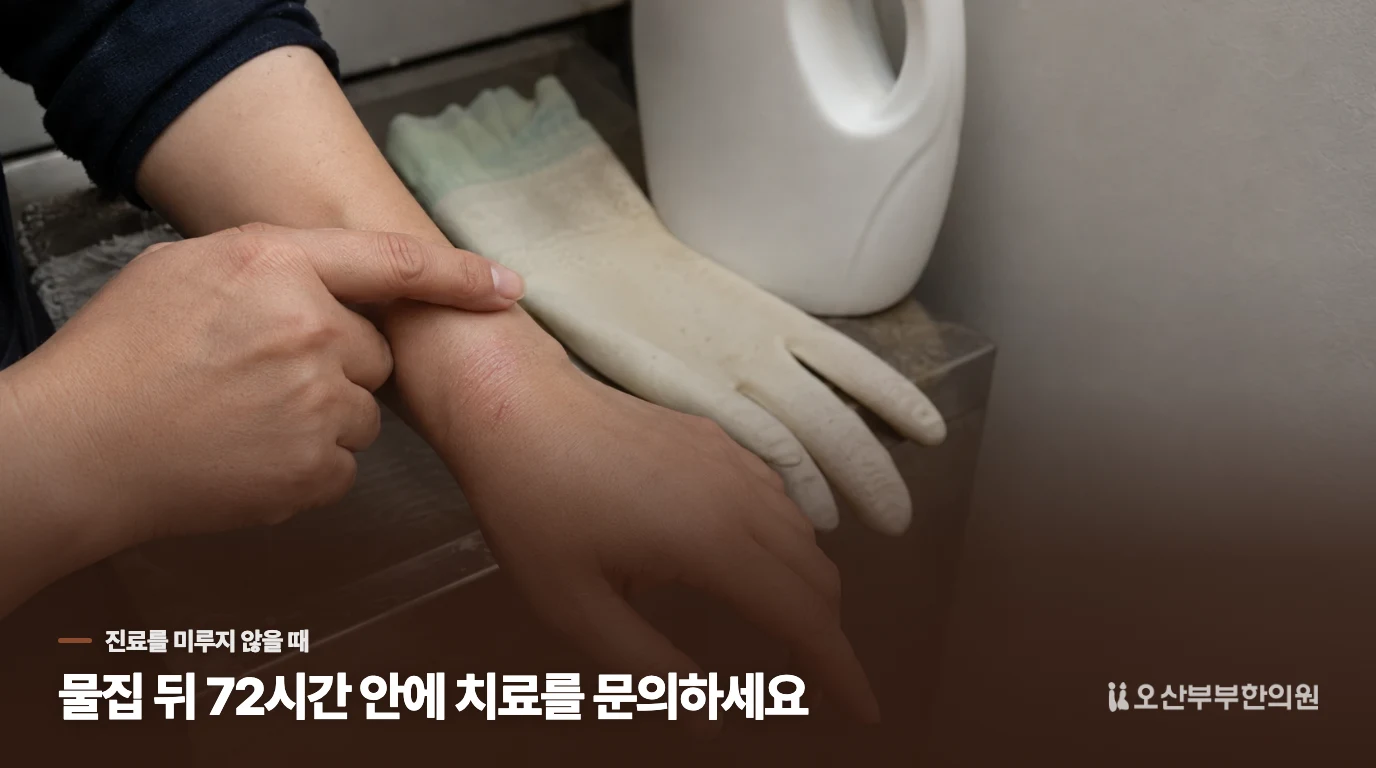 물집이 보이면 72시간을 기다리지 말고 치료 가능 시간을 묻습니다
