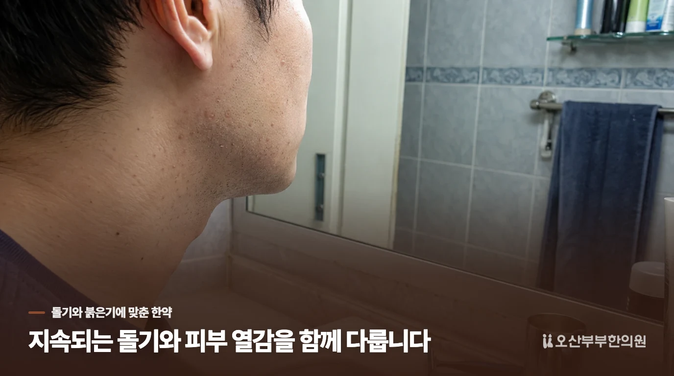 지속되는 돌기와 피부 열감을 함께 다룹니다
