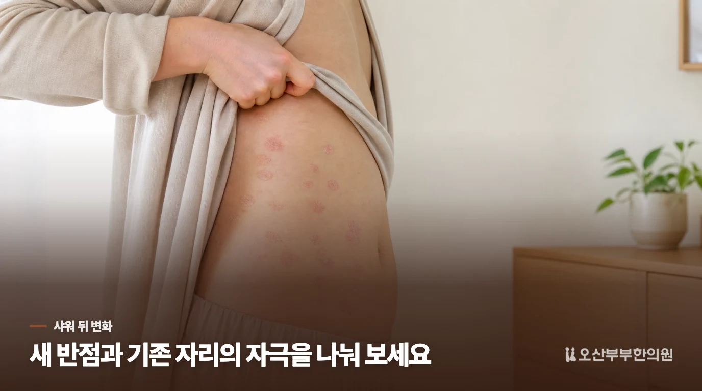 씻고 나왔는데 반점이 더 선명해졌다면