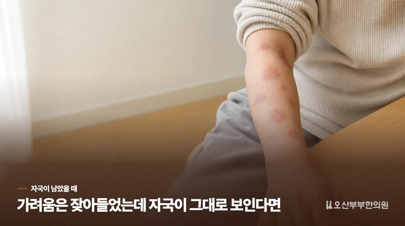 가려움은 잦아들었는데 자국이 그대로 보인다면