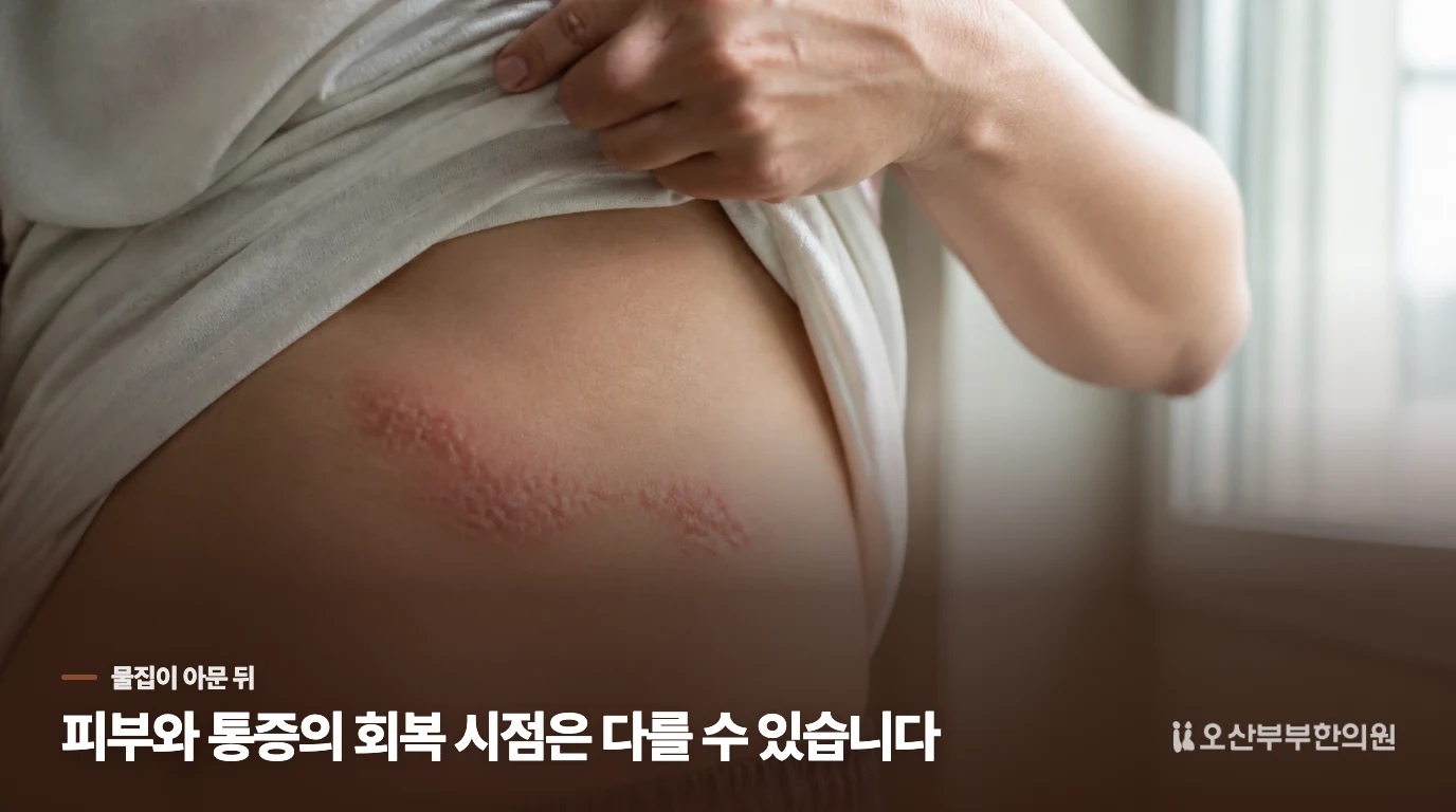 물집은 아물었는데 속옷 솔기가 닿을 때마다 아프다면