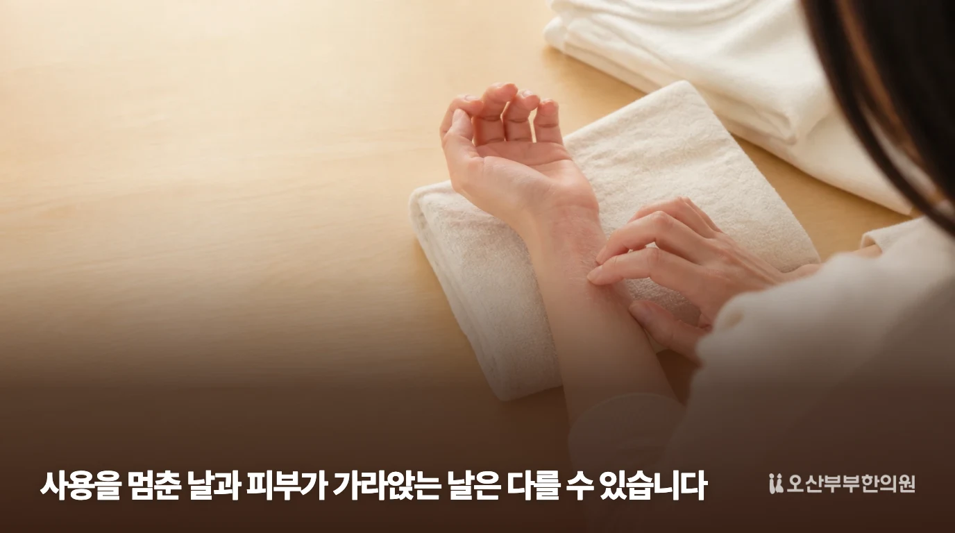 붉은 피부 발진을 보여주는 접촉피부염 설명 이미지